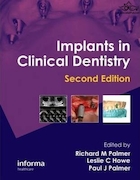 Implants in Clinical Dentistry 2nd Edición | ایمپلنت در دندانپزشکی بالینی